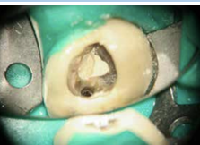 Curriculum Endodontologie